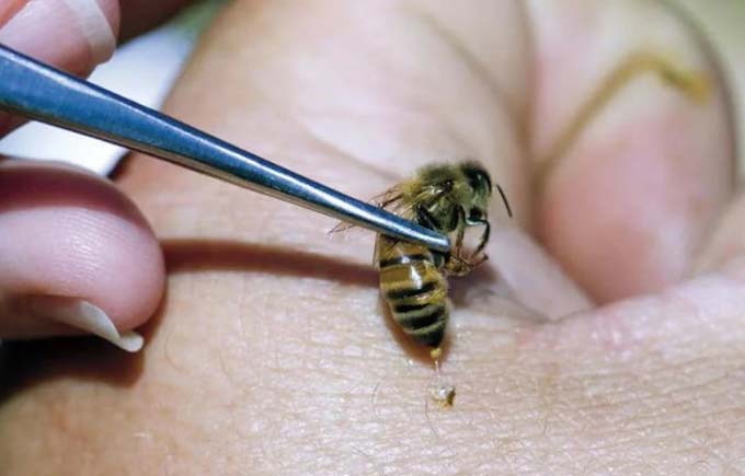 picada de abelha